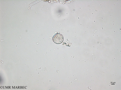 phyto/Brazilian_Amazon_coast/Amazomix_station_22/AMAZOMIX September 2021/Phalacroma rotundatum (St22_DCM_dinophysis220913_001_ovl-3).tif(copy)_thumb.jpg